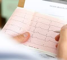 12-lead ECG territory and lead-orientation quick-reference chart