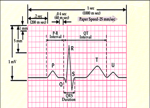 ECG paper calibration showing small and large squares for time and voltage measurement
